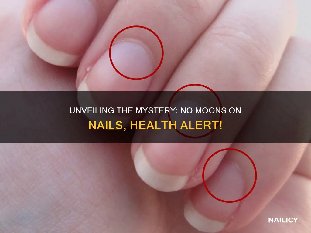 what no moons in finger nails indicates about health