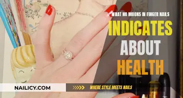 No Moons in Fingernails: Health Indicators You Should Know