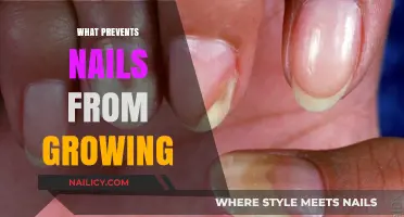 Nail Growth: What's Stopping Your Nails From Growing?