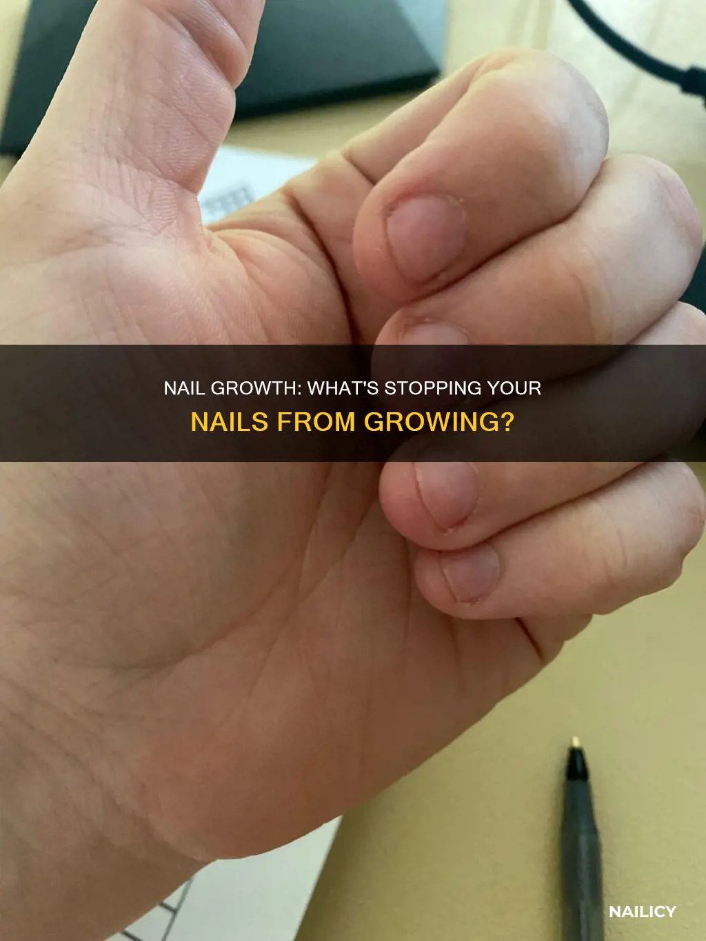 what prevents nails from growing