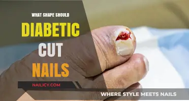 Diabetics' Guide to Nail Care and Trimming