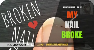 Broken Nail Emergency: Quick Fixes and Care Tips for Healthy Nails