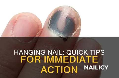 what should indo if my finger nail is hanging off