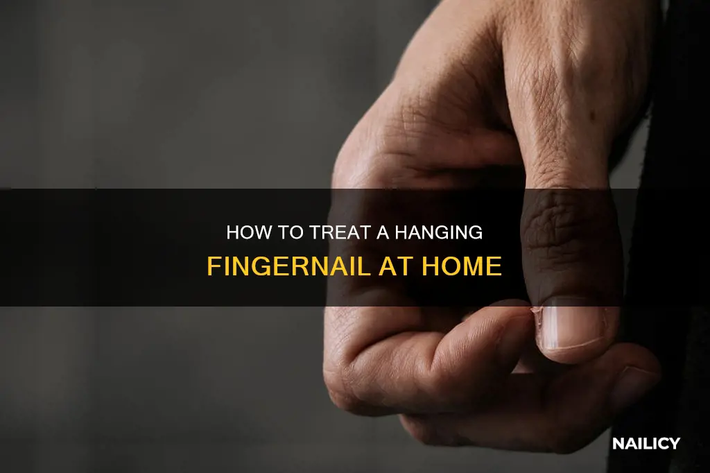 what should indo if my finger nail is hanging off