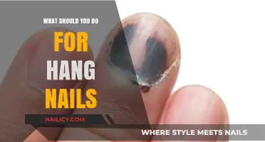 Effective Hang Nail Remedies: Quick Tips for Healthy, Pain-Free Cuticles