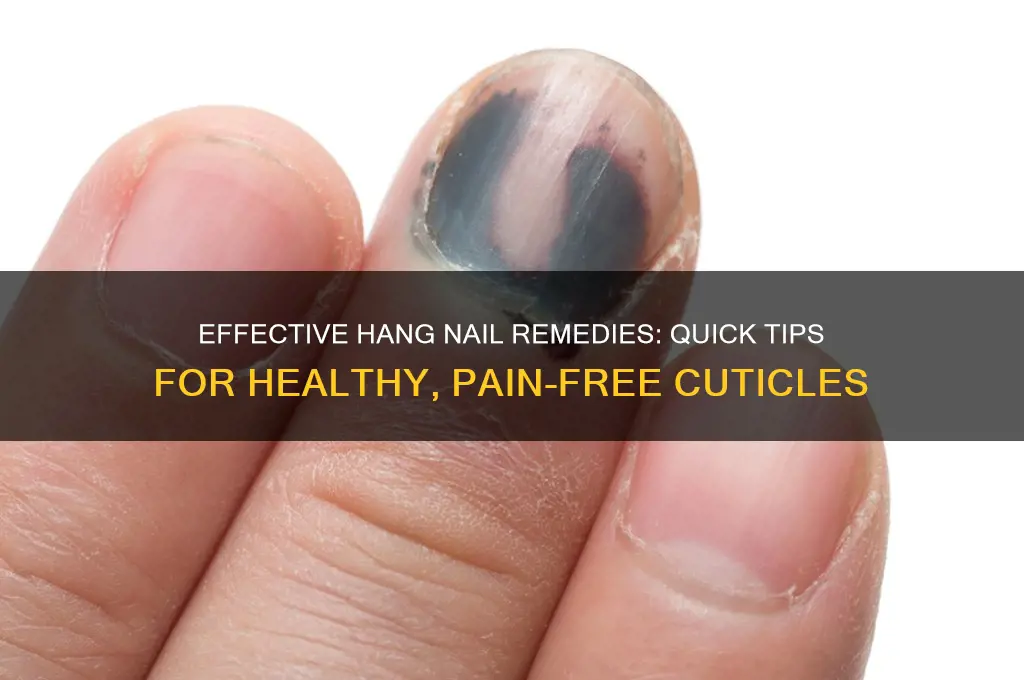 what should you do for hang nails
