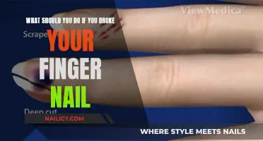 Immediate Care for a Broken Fingernail