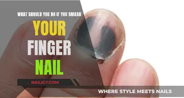 Immediate Care for a Smashed Fingernail