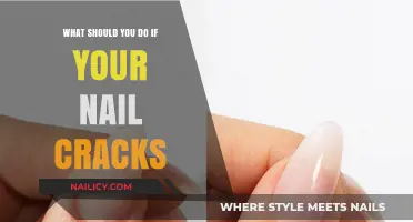 Cracked Nail Emergency: Quick Fixes and Prevention Tips for Healthy Nails