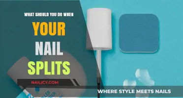 Quick Fixes and Care Tips for Split Nails: A Comprehensive Guide