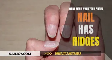 Unraveling the Mystery: What Your Rippled Nails Might Tell You