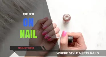 Understanding the Meaning Behind a Spot on Your Nail