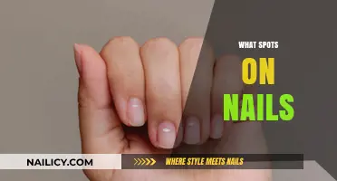 Understanding Nail Spots: Causes, Concerns, and When to Seek Help