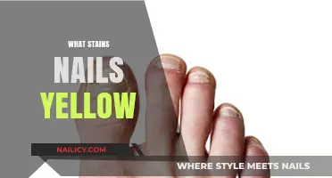 Why Nails Turn Yellow: Causes, Prevention, and Solutions Explained