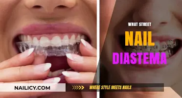 Understanding Street Nail Diastema: Causes, Trends, and Aesthetic Impact