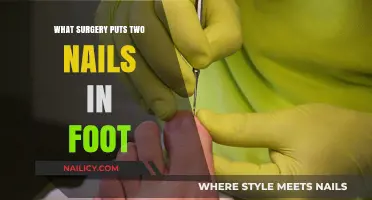 Understanding the Foot Surgery Involving Two Nails: Procedure and Recovery