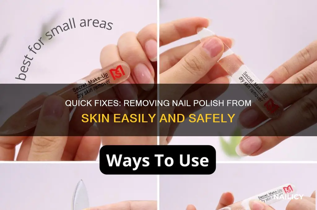 what takes nail polish off skin
