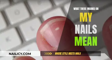 Understanding Nail Markings: What Do They Mean?
