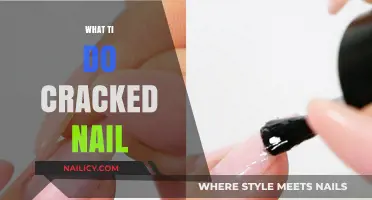 Quick Fixes for Cracked Nails: Restore Strength and Beauty Fast