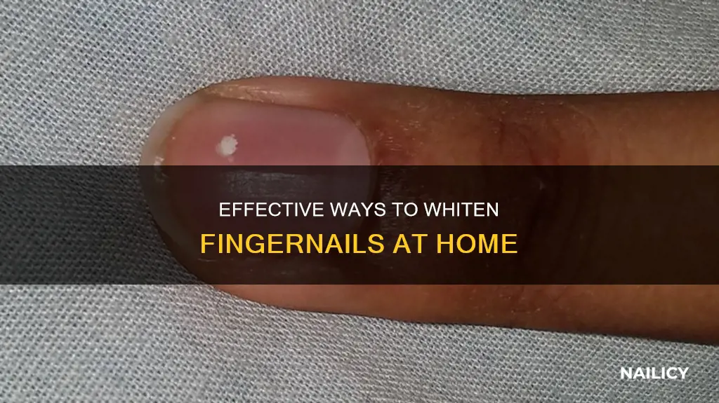 what to clean my finger nails with to whitening them