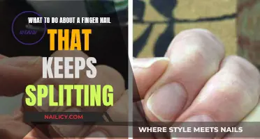Fixing a Fingernail That Keeps Splitting