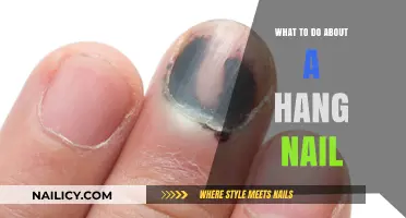 Quick Fixes for Hang Nails: Prevent Pain and Promote Healing