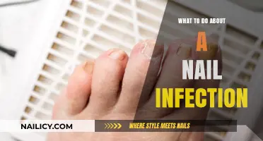 Effective Remedies and Prevention Tips for Treating Nail Infections