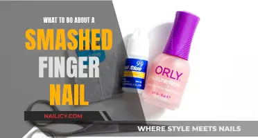 Fixing a Smashed Nail: Quick Tips for a Quick Fix