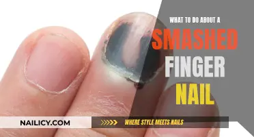 Immediate Care for a Smashed Fingernail