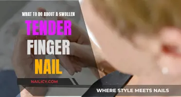 Relieve a Sore, Swollen Fingernail: Quick Tips and Tricks