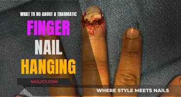 Fixing a Traumatic Hangnail: Quick Tips for Relief