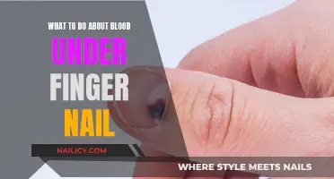 Blood Under Your Nail: Quick Tips for Immediate Action