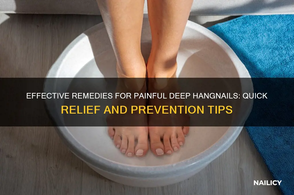 what to do about deep hang nail