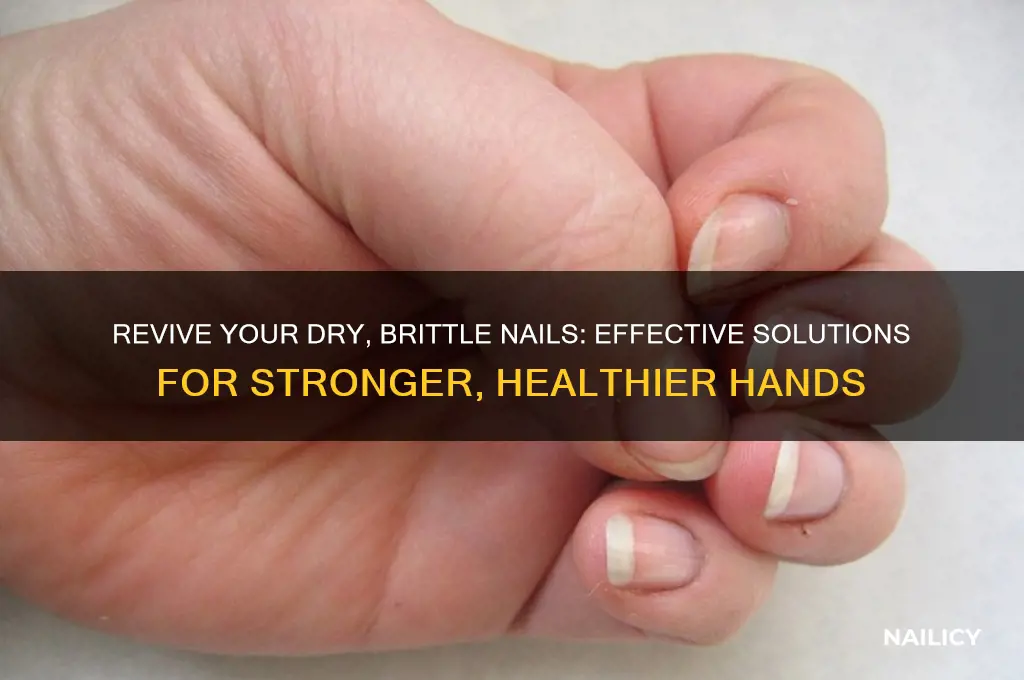 what to do about dry brittle nails