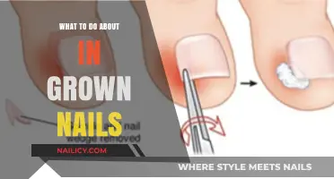 Effective Remedies and Prevention Tips for Painful Ingrown Toenails