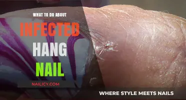 Treating Infected Hang Nails: Quick Remedies and Prevention Tips