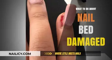 Healing Damaged Nail Beds: Effective Remedies and Prevention Tips