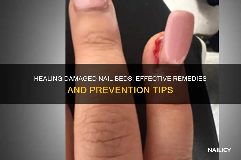 what to do about nail bed damaged
