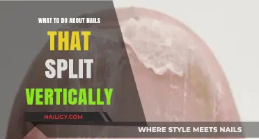 Fixing Vertical Nail Splits: Effective Solutions for Stronger, Healthier Nails