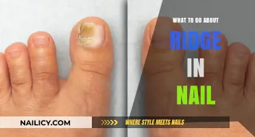 Ridge in Nail? Causes, Concerns, and Effective Solutions Explained