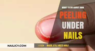 Skin Peeling Under Nails: Causes, Remedies, and Prevention Tips
