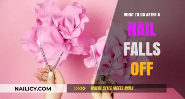 Nail Emergency: Quick Steps to Heal and Protect After a Lost Nail