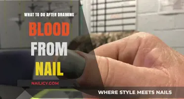 Post-Drain Care: Essential Steps After Blood Removal from Nail