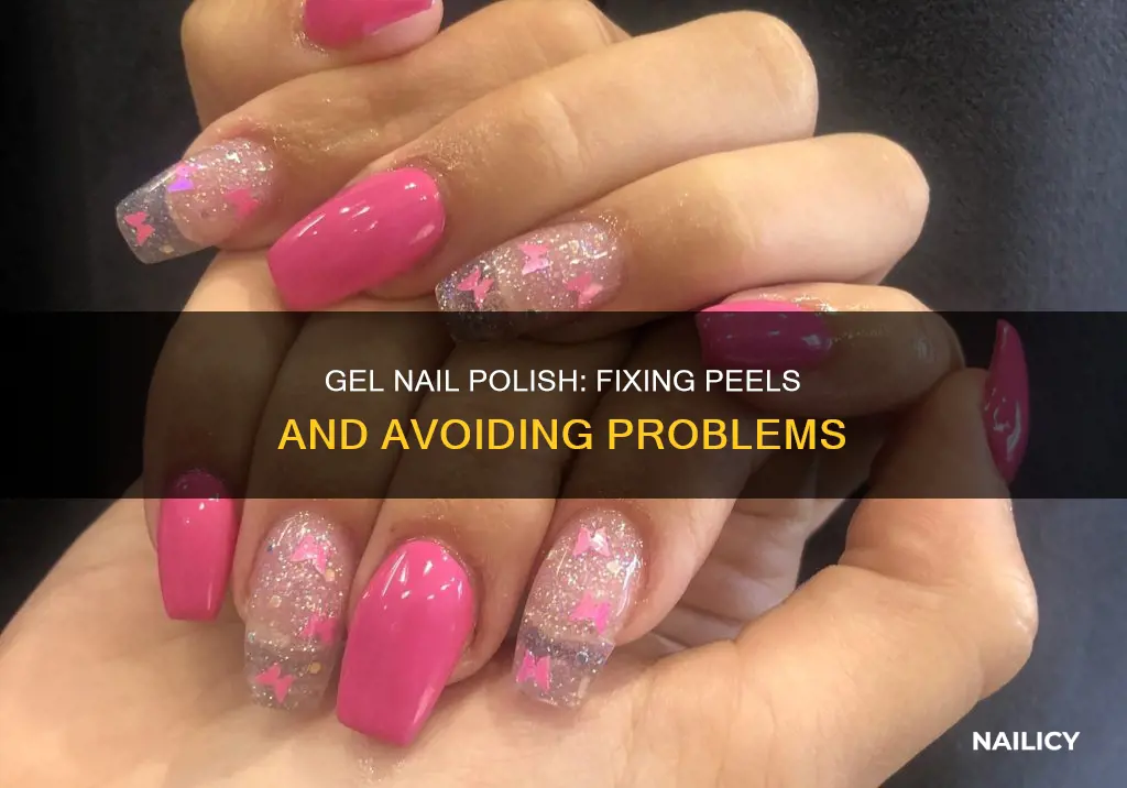 what to do after gel nail polish peels