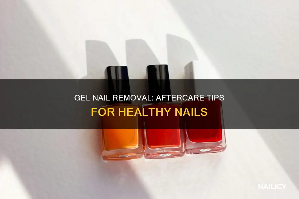 what to do after gel nail removal