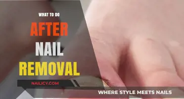 Post-Nail-Removal Care: Steps to Take