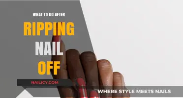 Immediate Steps and Care After Ripping a Nail Off: A Guide