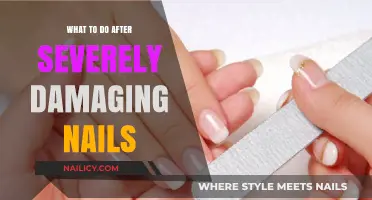Nail Rehab: Effective Steps to Heal Severely Damaged Nails Fast