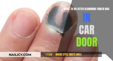 Fingernail Slam: Quick Tips for Pain Relief and Repair