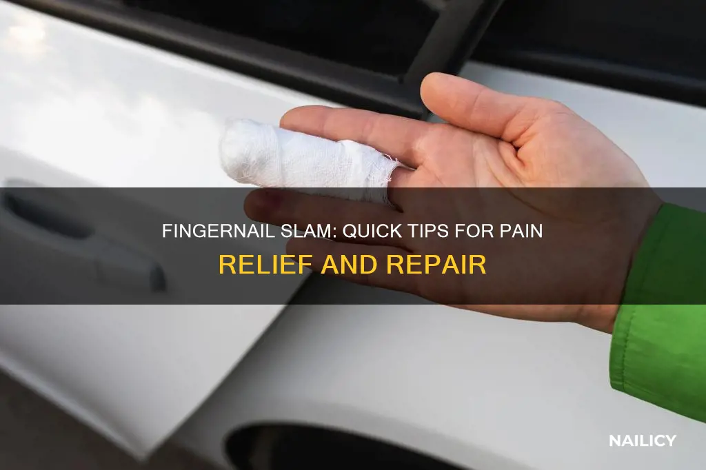 what to do after slamming finger nail in car door